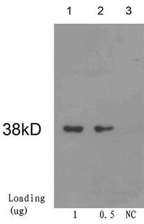 Cre Recombinase Mouse anti.